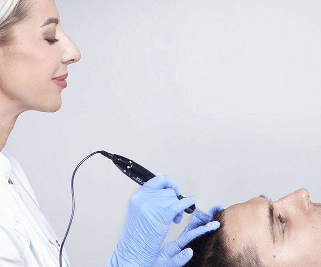 inovativni microneedling tretman kose u beogradu